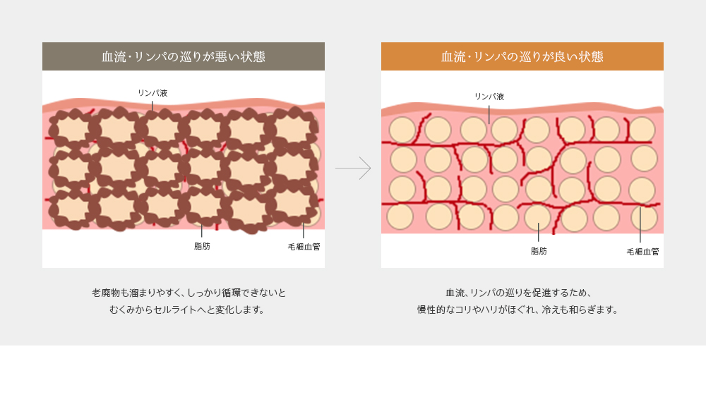 血流・リンパの巡りが悪い状態と良い状態を比較