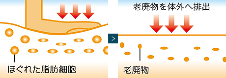 痩身効果