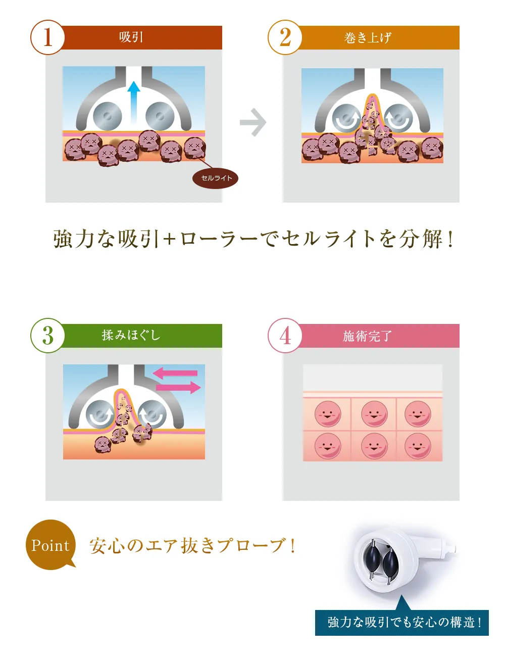 強力な吸引＋ローラーでセルライトを分解！安心のエア抜きプローブ！