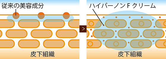 特別価格みっきー様専用　ハイパーノンFクリーム 脱毛・除毛クリーム