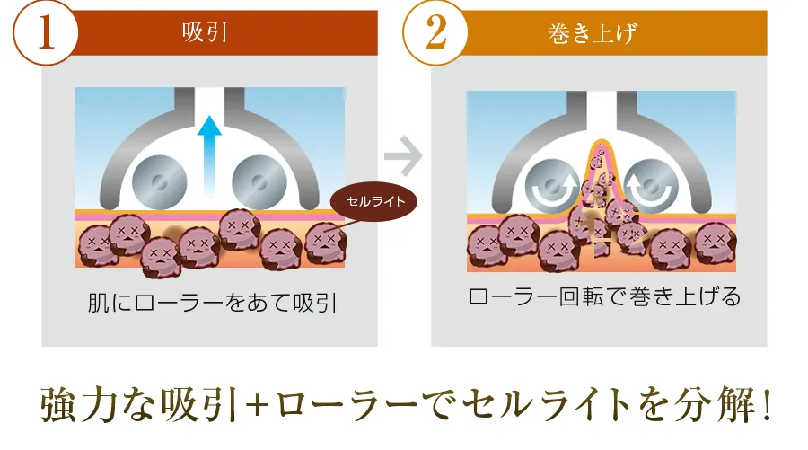 HyperShape ハイパーシェイプ　ワム 株式会社ワムのハイパーシェイプ®