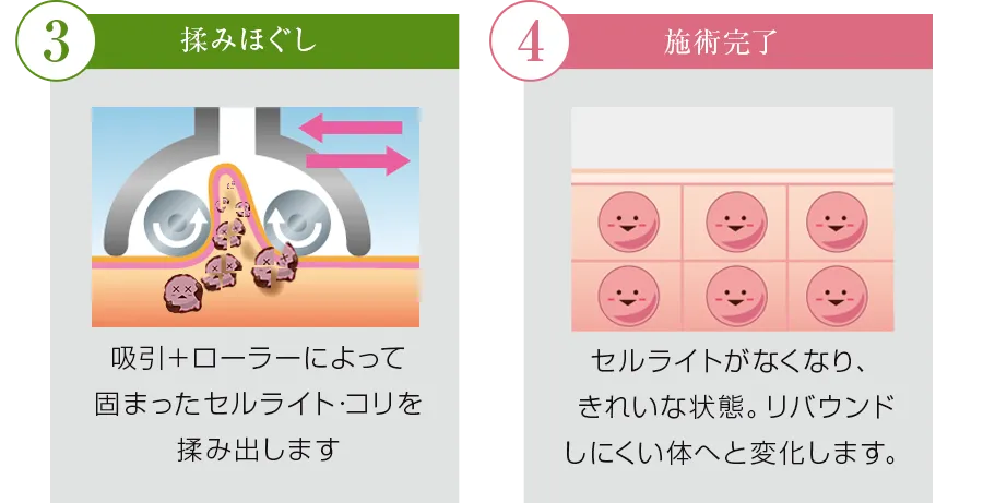 ハイパーシェイプ【ワム】正規品　お値引きしました★ 株式会社ワムのハイパーシェイプ®