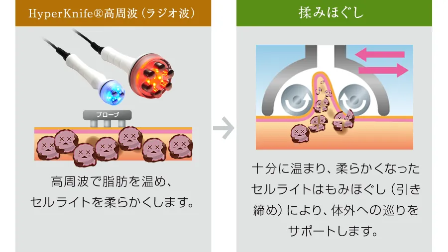 株式会社ワムのハイパーシェイプ® 株式会社ワムのハイパーシェイプ®