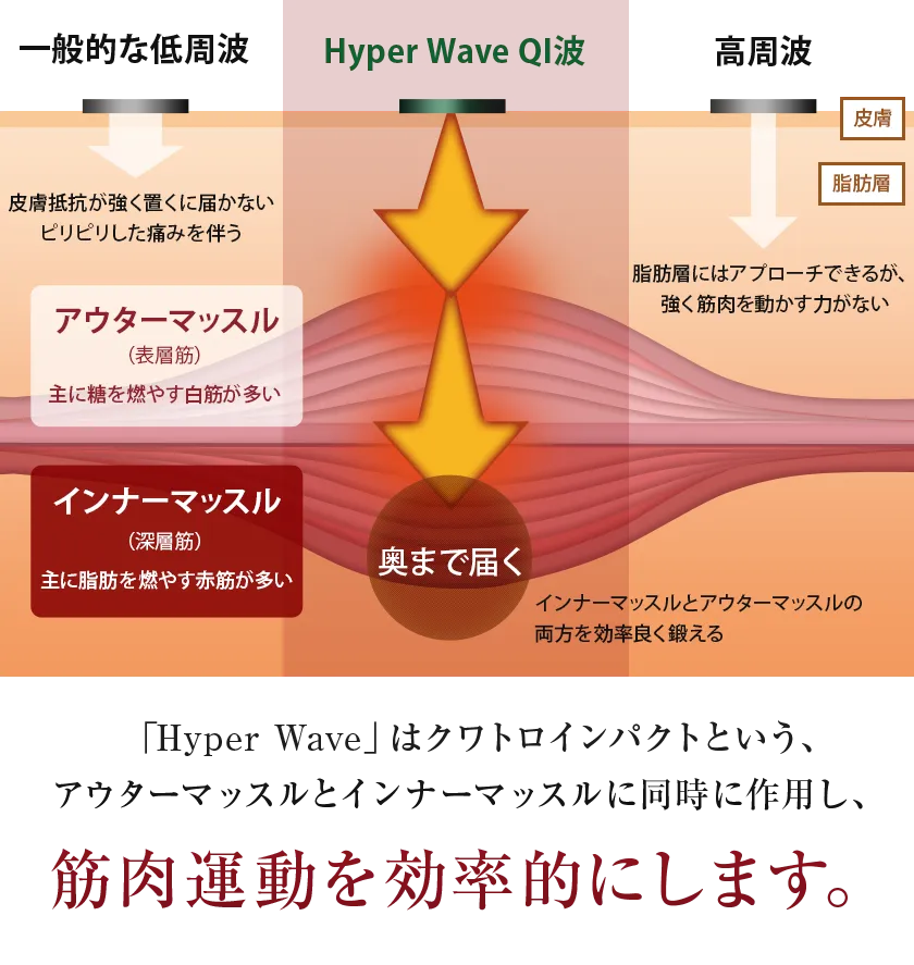 正規品ハイパーウェーブＥＭＳ★ワム 株式会社ワムのハイパーウェーブ®（QI波マシン）